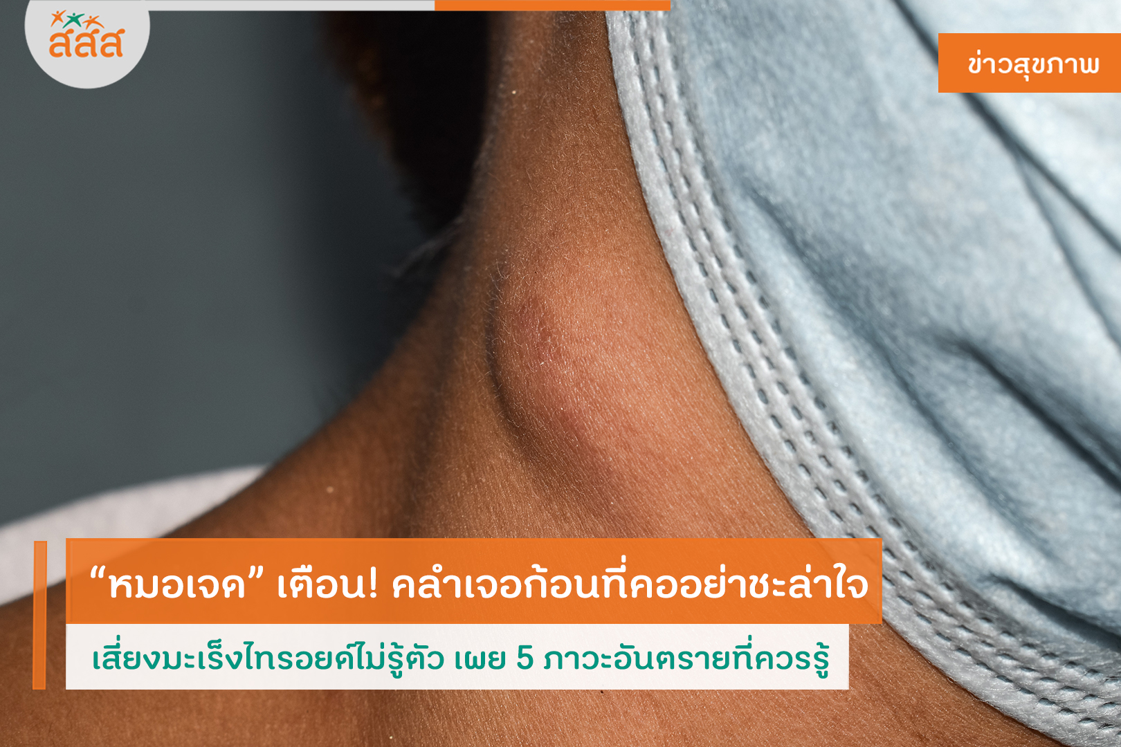 ปกข่าวสุขภาพ “หมอเจด” เตือน! คลำเจอก้อนที่คออย่าชะล่าใจ เสี่ยงมะเร็งไทรอยด์ไม่รู้ตัว เผย 5 ภาวะอันตรายที่ควรรู้